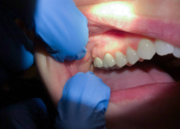 Best Emergency Dentist for Special Needs Patients in Sinton, TX